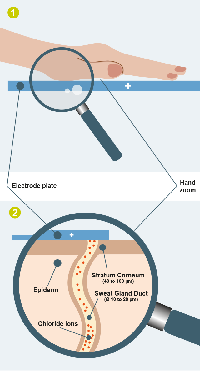 visuel-a-testof-sudoral-function-smartphone