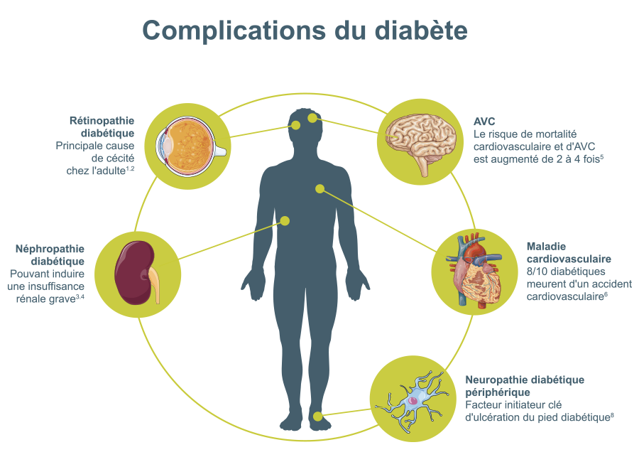 visuel-diabète-complications-fr-2021